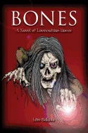 Bones